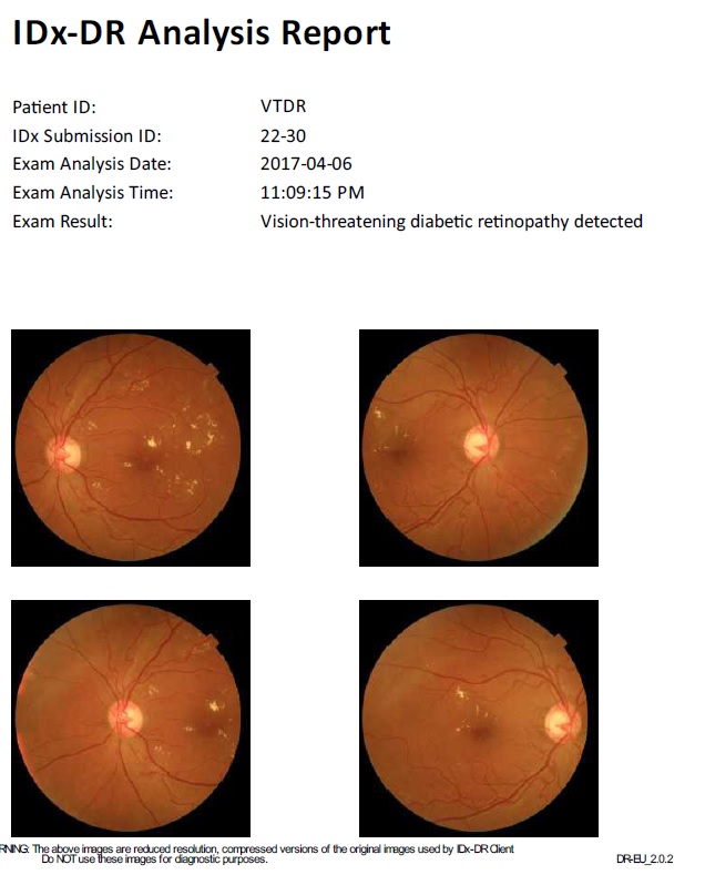 resultados deteccion retinopatia diabetica